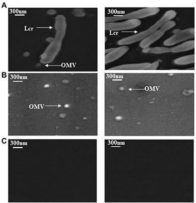 Proteomic and bioinformatic analyses of proteins in the outer membrane and extracellular compartments and outer membrane vesicles of Candidatus Liberibacter species